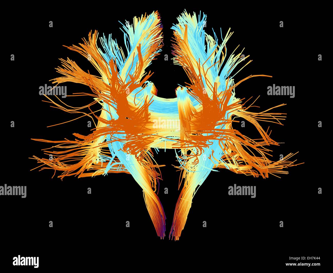 White matter fibres of the human brain Stock Photo