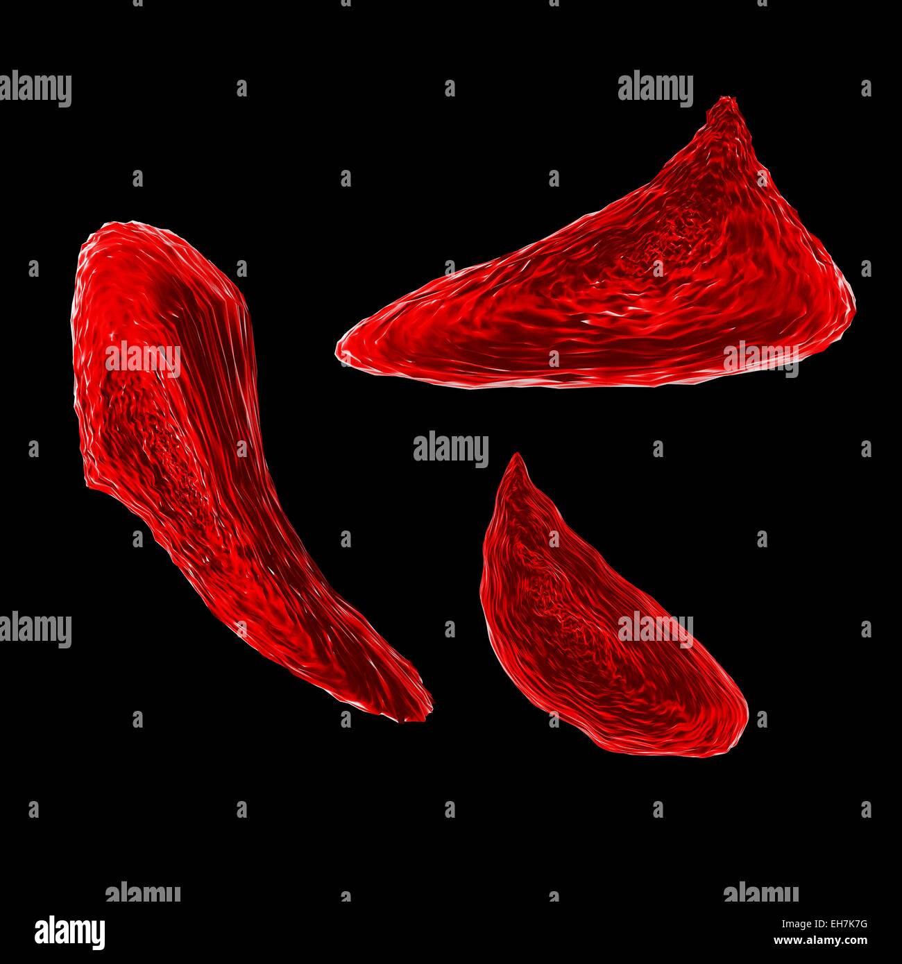 Sickle cell anaemia, illustration Stock Photo