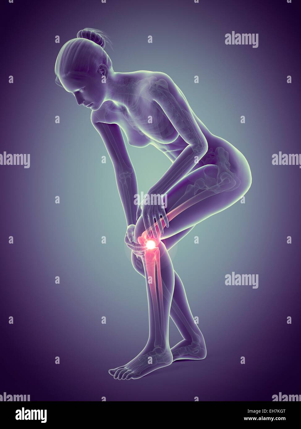 Human knee pain, illustration Stock Photo - Alamy