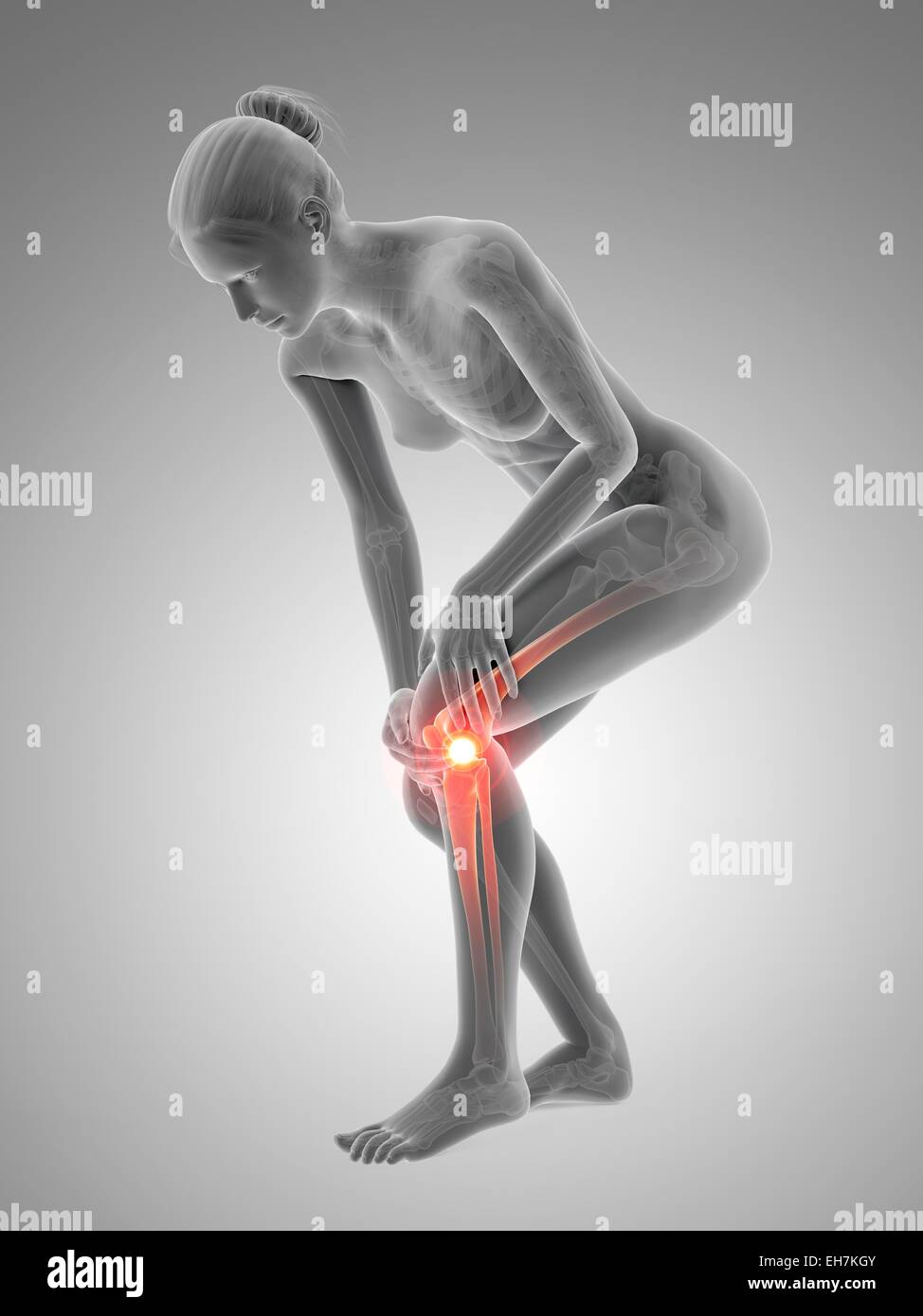Human knee pain, illustration Stock Photo - Alamy
