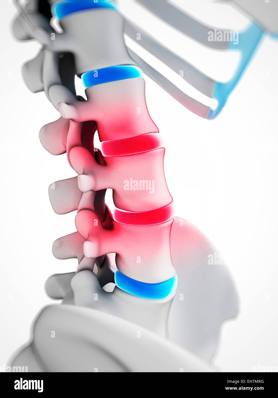 Human spinal discs, illustration Stock Photo - Alamy