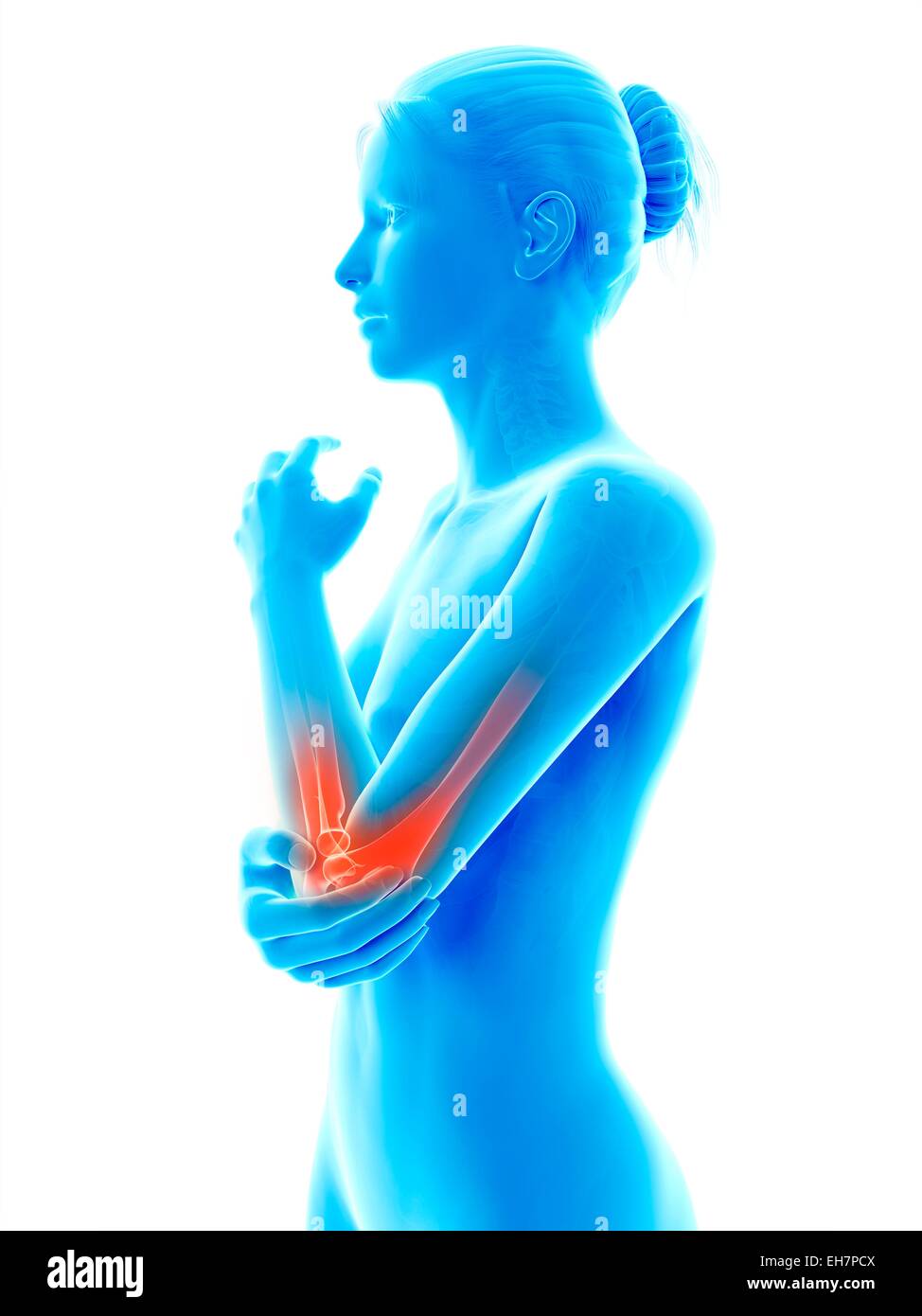 Human elbow joint pain, illustration Stock Photo Alamy