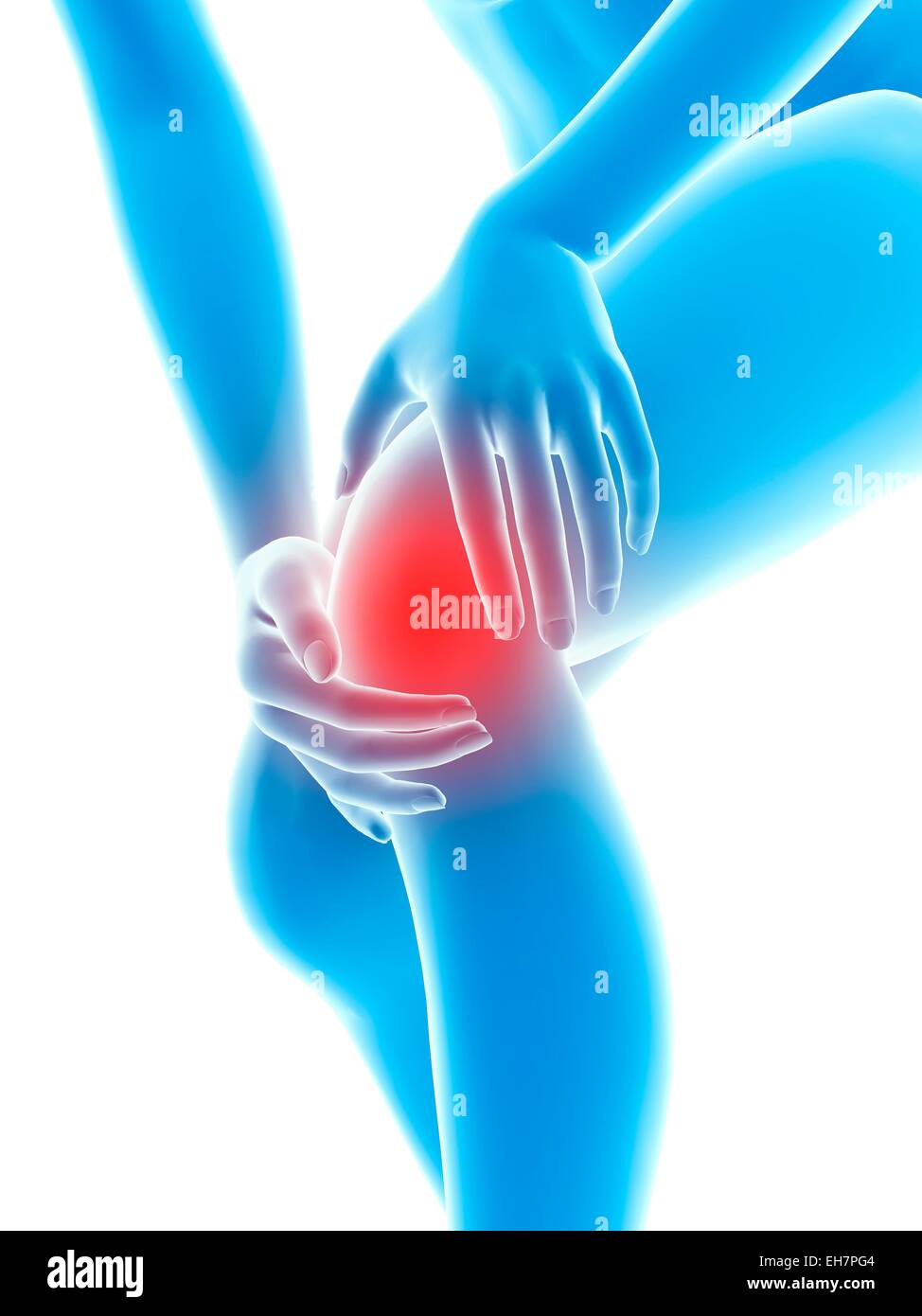 Human knee pain, illustration Stock Photo - Alamy