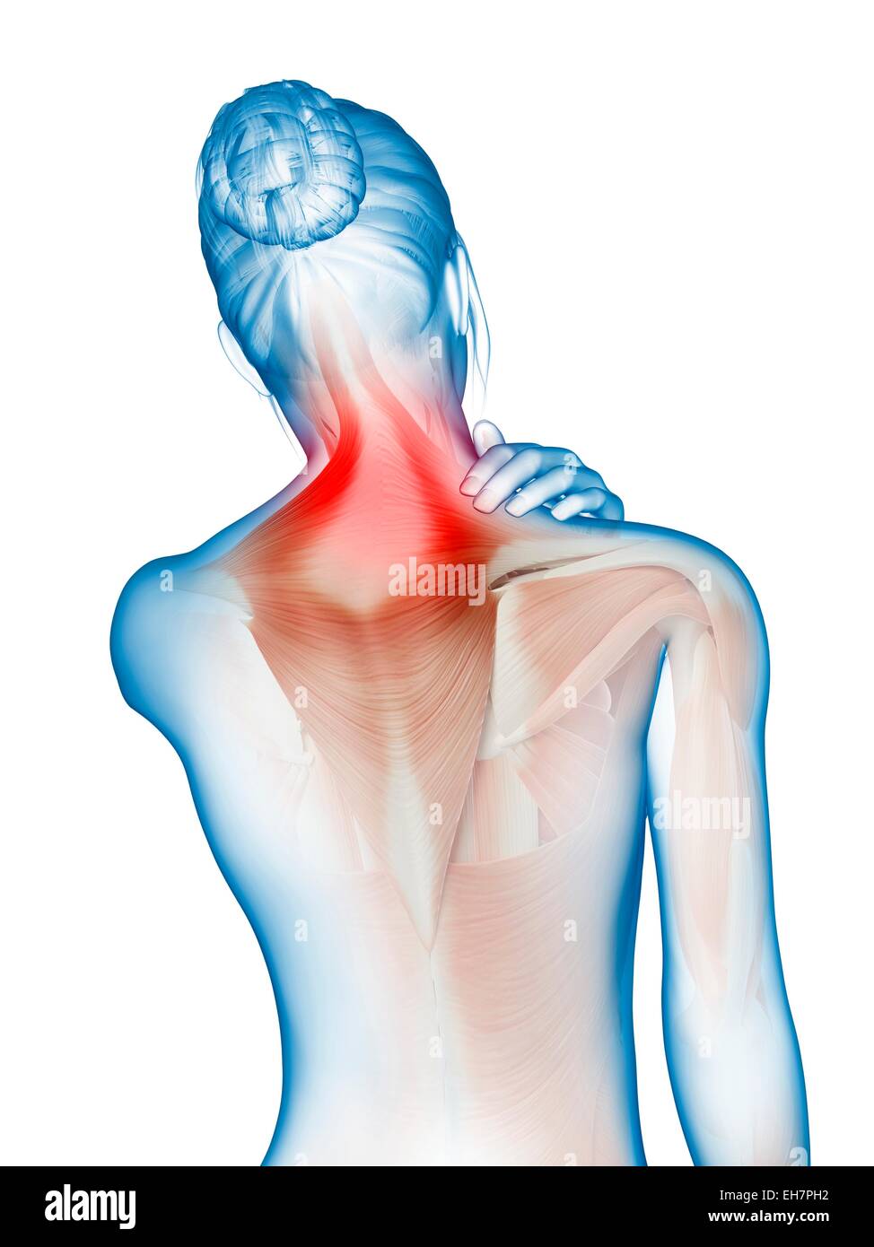 Human neck muscles, illustration Stock Photo