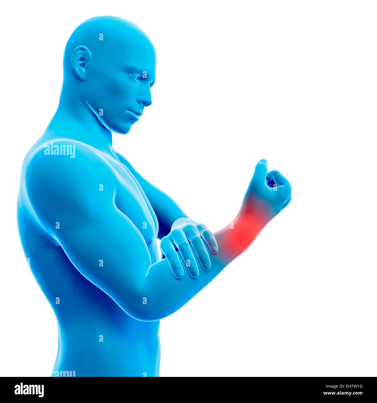 Human wrist pain, illustration Stock Photo Alamy