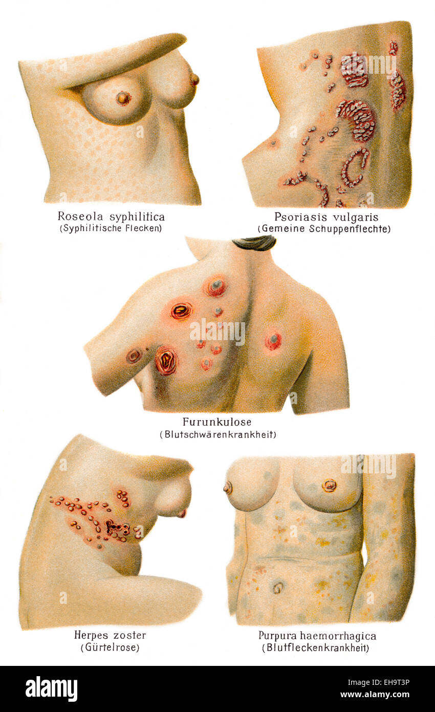 cutaneous conditions, health counselor, 19th century, Stock Photo