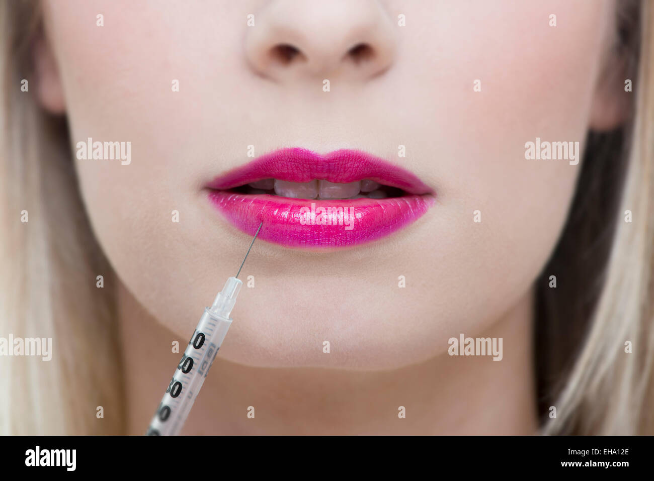botox lip injection Stock Photo Alamy