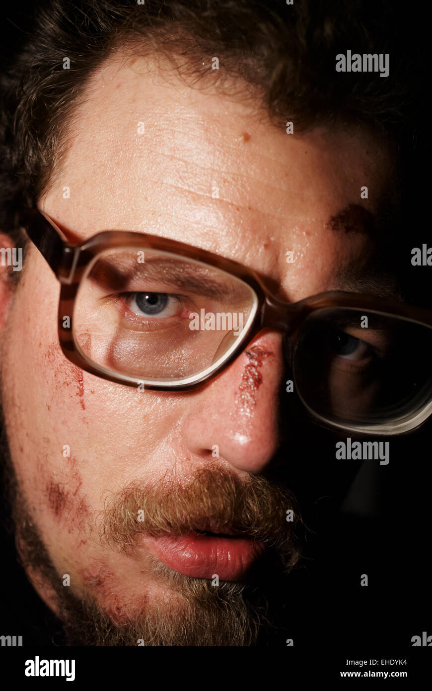 Man on glass with small sores on face Stock Photo