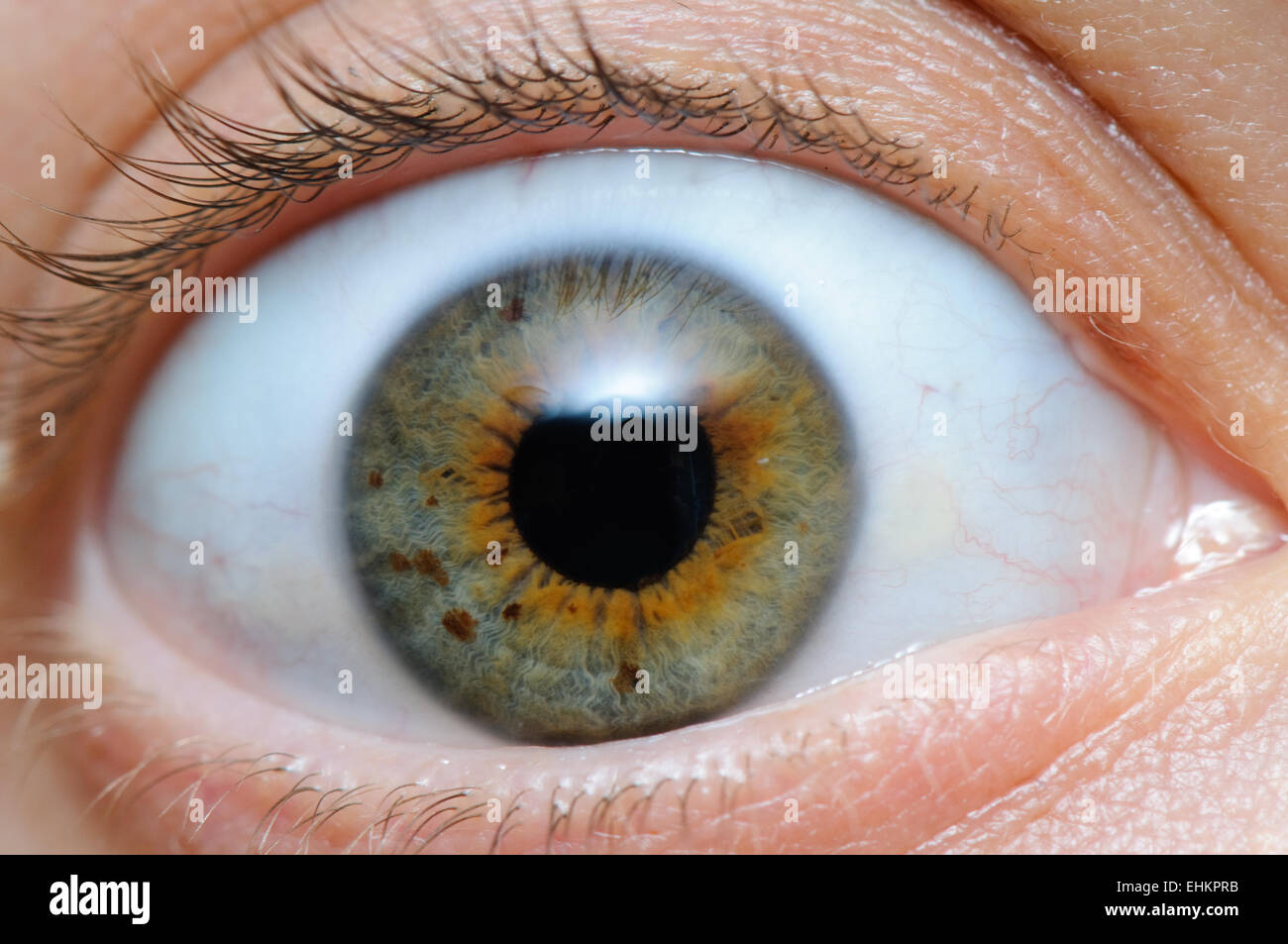 Eye red veins hires stock photography and images Alamy