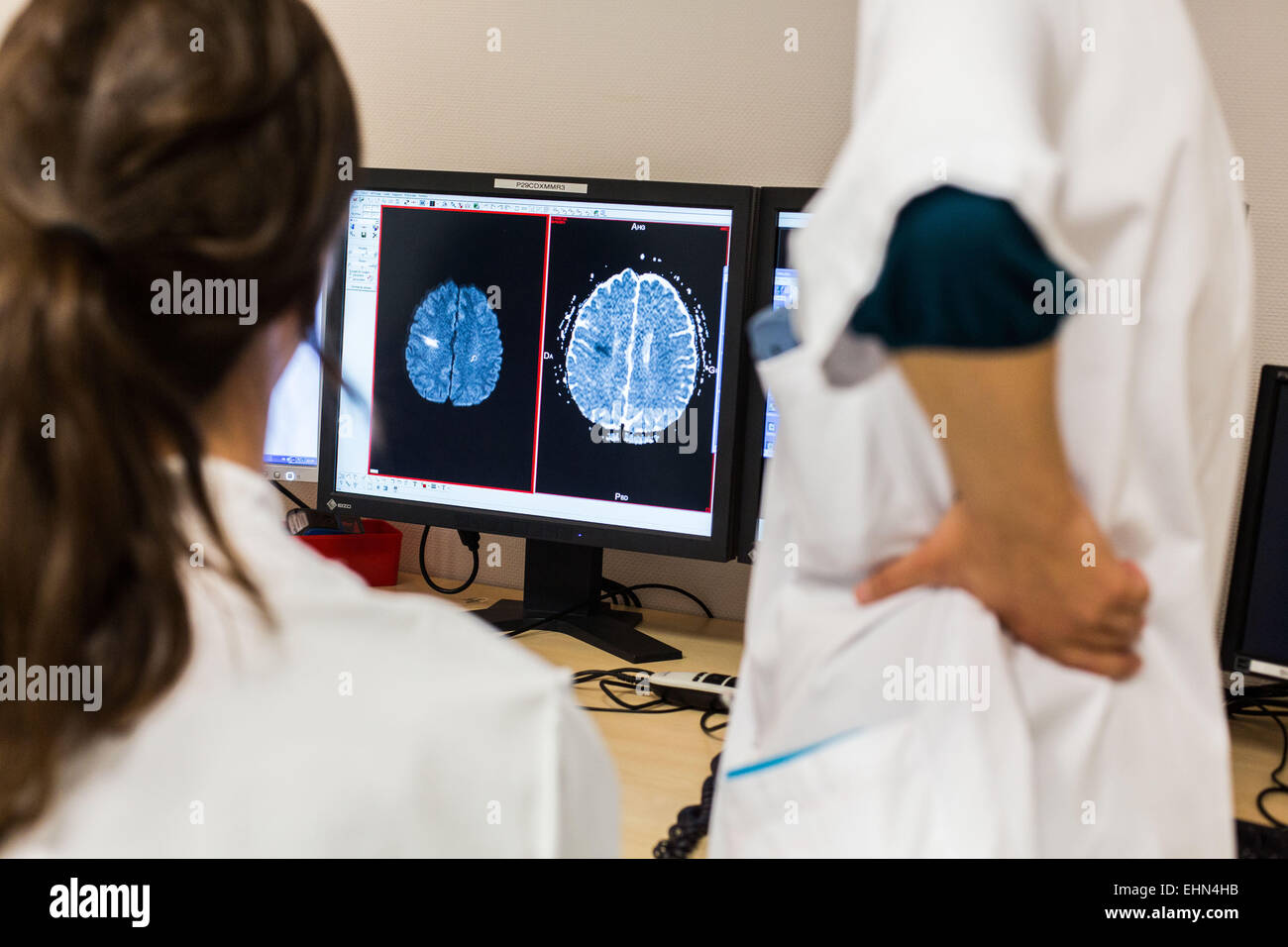 Doctors studies CT and MRI scans of a stroke victim, Bordeaux hospital, France. Stock Photo