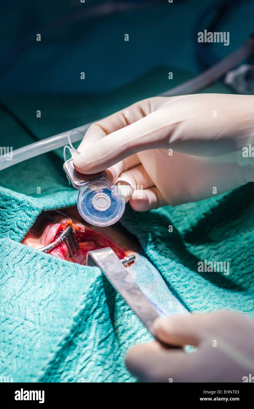 Cochlear Implant Deaf High Resolution Stock Photography and Images Alamy