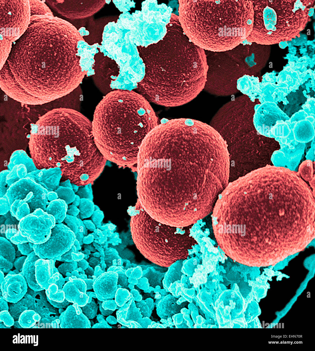 Coloured scanning electron micrograph (SEM) of methicillin-resistant Staphylococcus aureus (MRSA) bacteria. Stock Photo