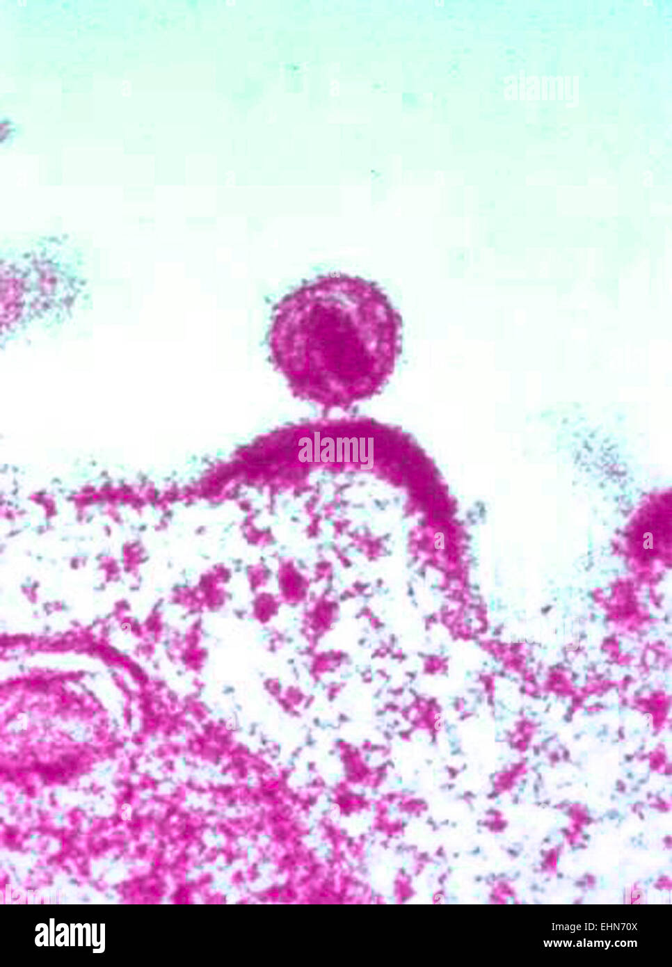 Detail of one human immunodeficiency virus (HIV) virus particle, or virion, Transmission Electron Micrograph (TEM). Stock Photo