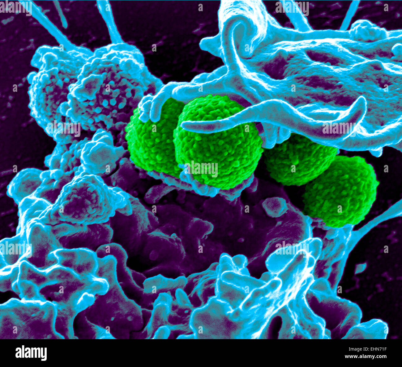 Coloured scanning electron micrograph (SEM) of methicillin-resistant Staphylococcus aureus (MRSA) bacteria. Stock Photo