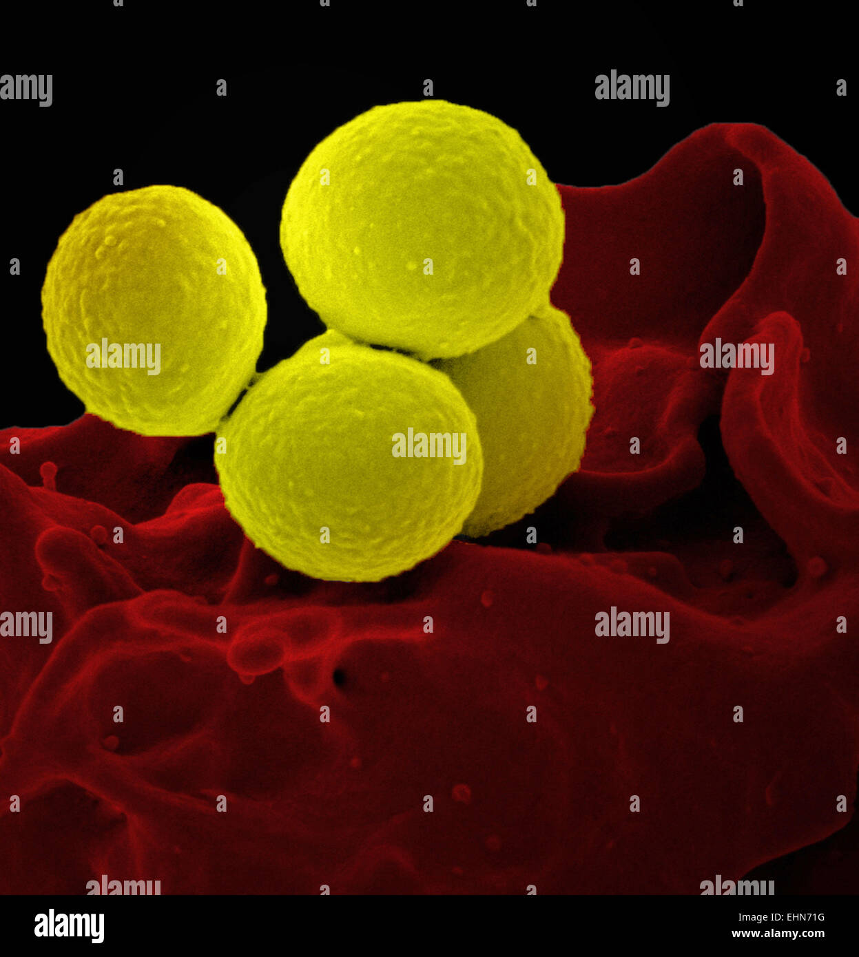 Coloured Scanning Electron Micrograph (SEM) Of Methicillin-resistant ...