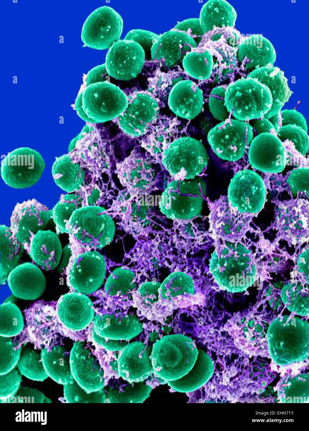 Staphylococcus pseudintermedius. Coloured scanning electron micrograph  (SEM) of Staphylococcus pseudintermedius bacteria. These Gram-positive  cocci (s Stock Photo - Alamy