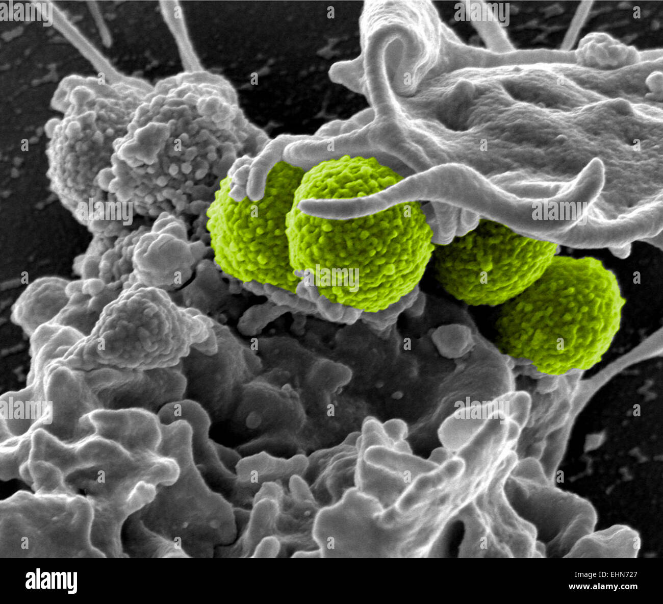 Coloured scanning electron micrograph (SEM) of methicillin-resistant  Staphylococcus aureus (MRSA) bacteria Stock Photo - Alamy