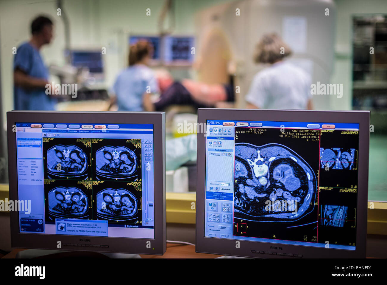 CT scanassisted biopsy, SaintLouis hospital, Paris, France Stock