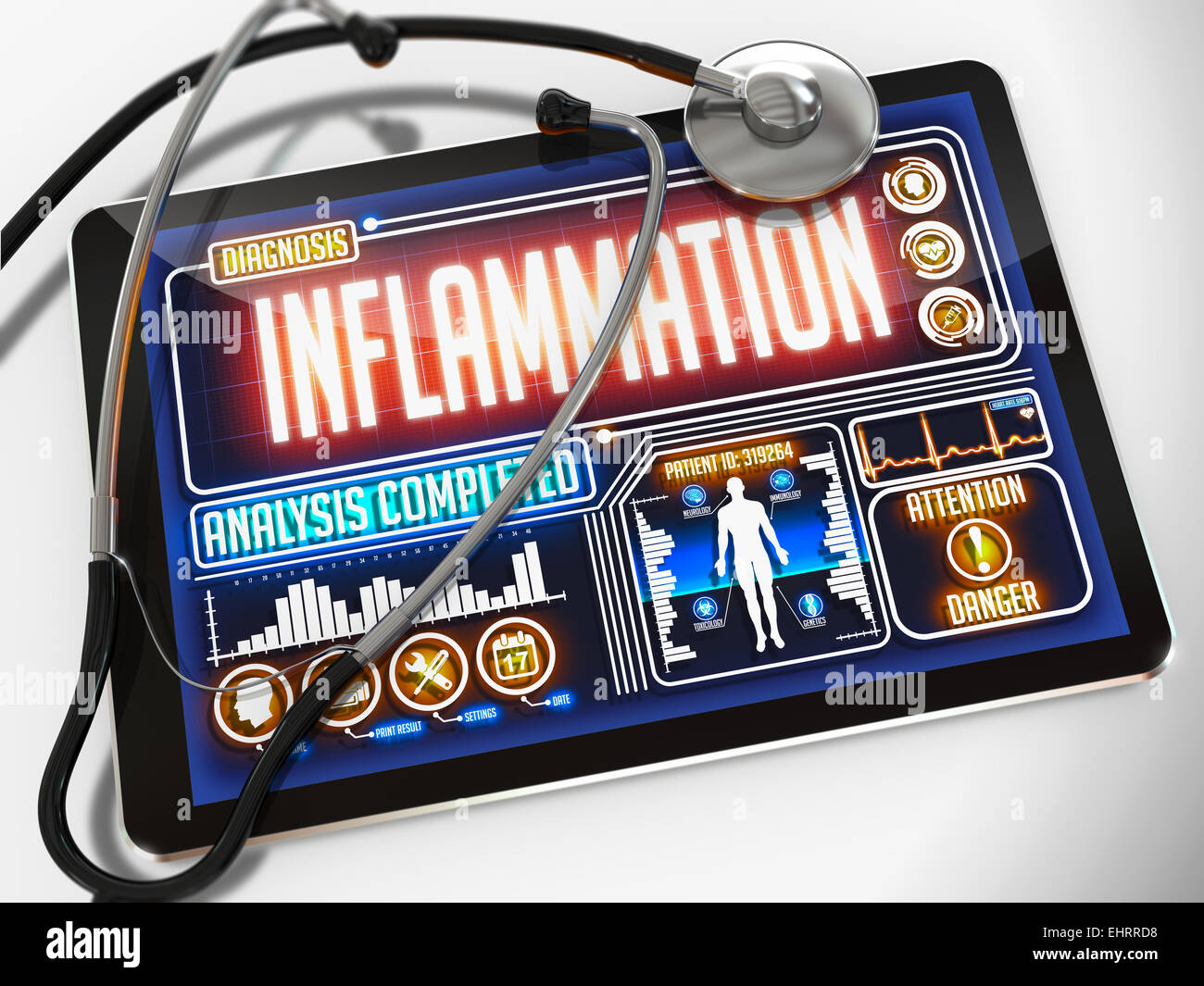 Inflammation on the Display of Medical Tablet. Stock Photo