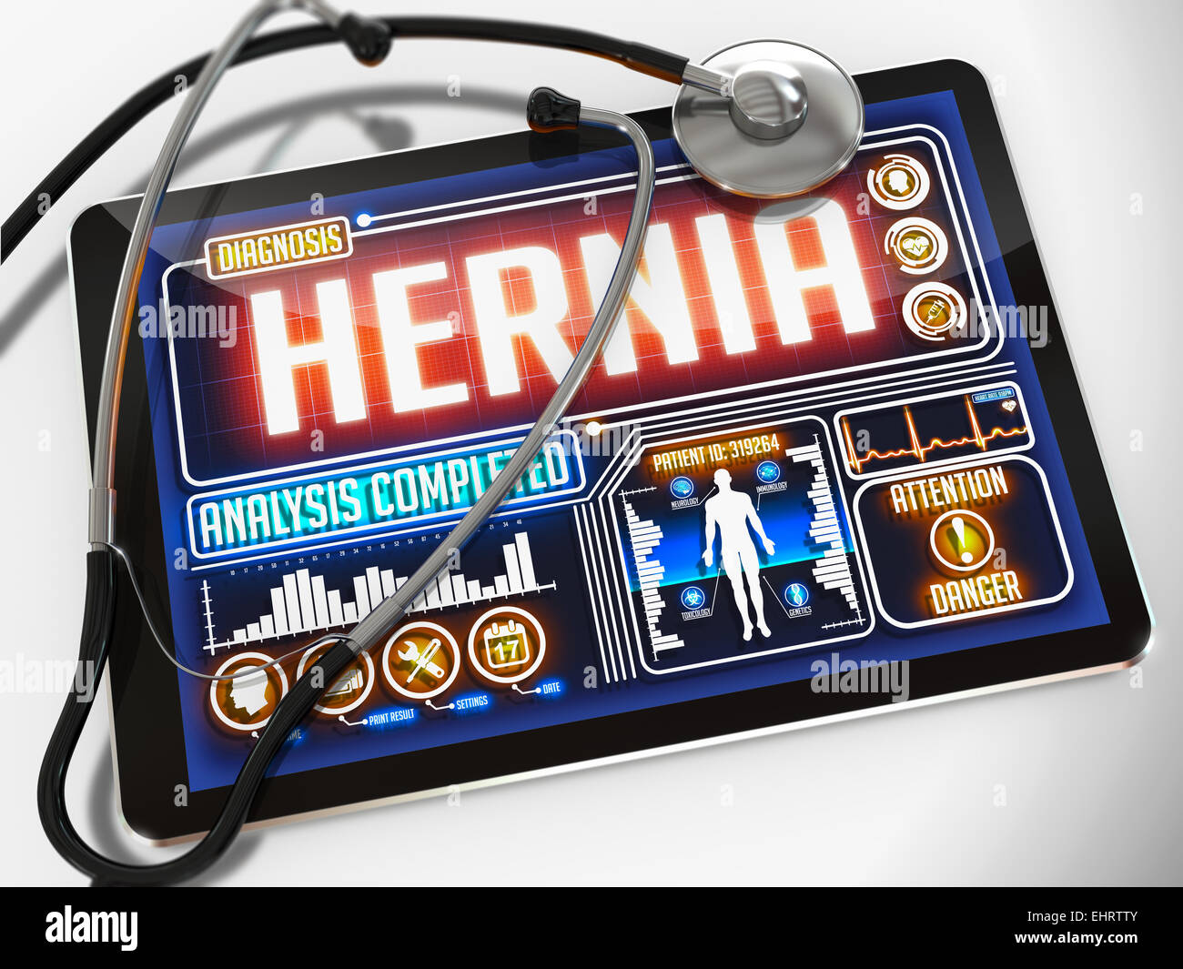 Hernia on the Display of Medical Tablet. Stock Photo