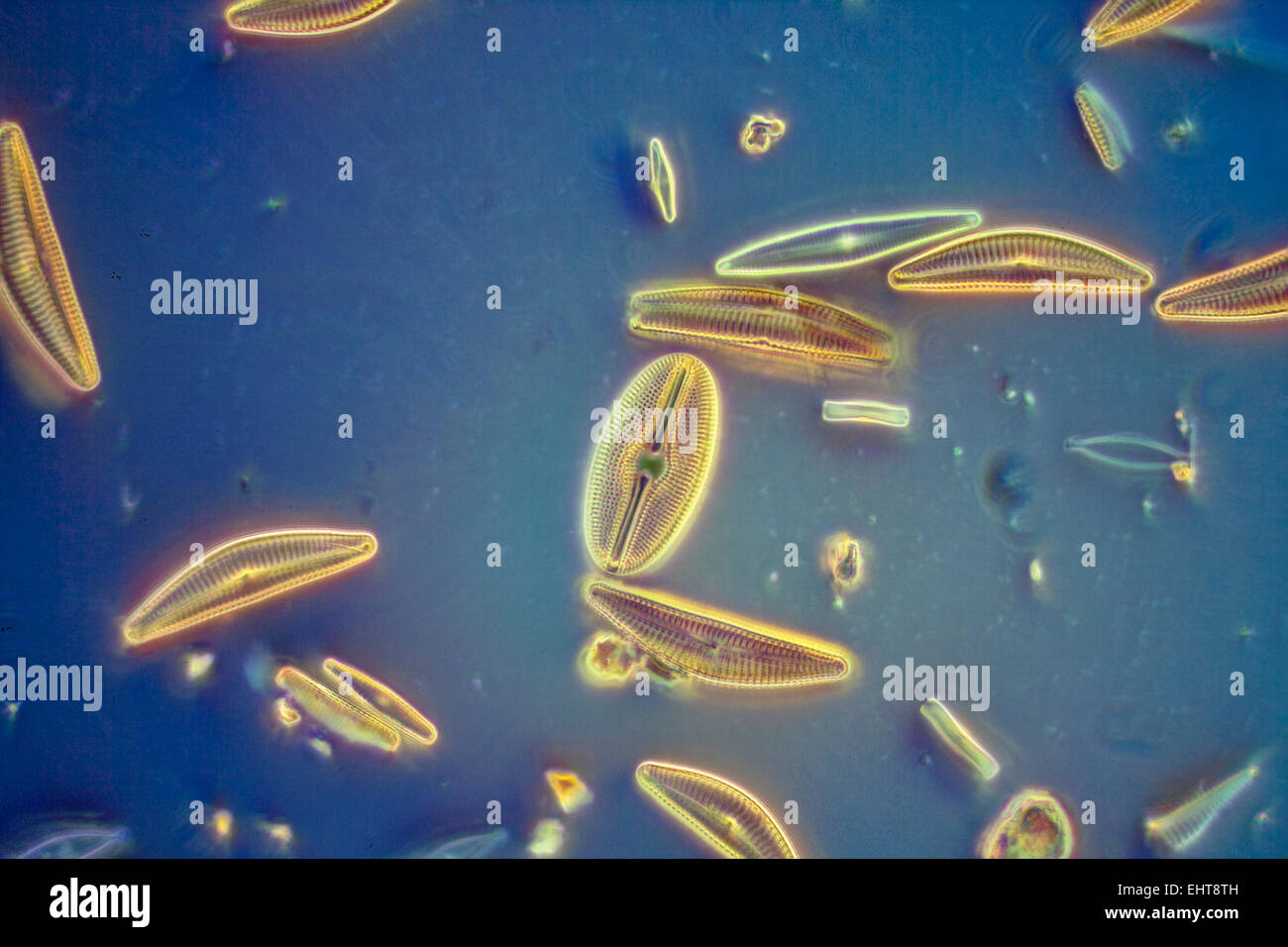 Freshwater diatoms Lancashire, darkfield photomicrograph Stock Photo