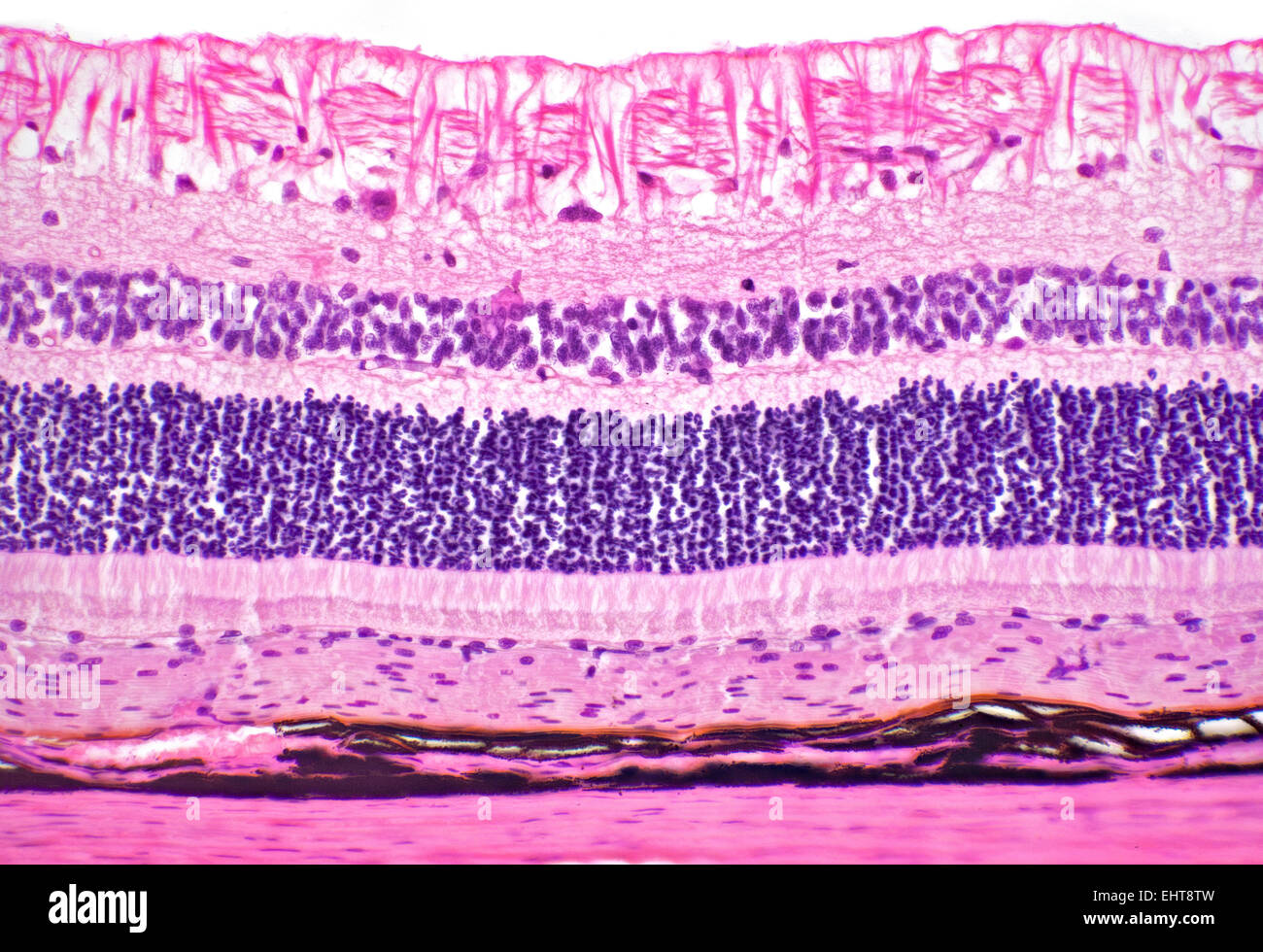 Cat eye retina detail, brightfield photomicrograph, stained section Stock Photo