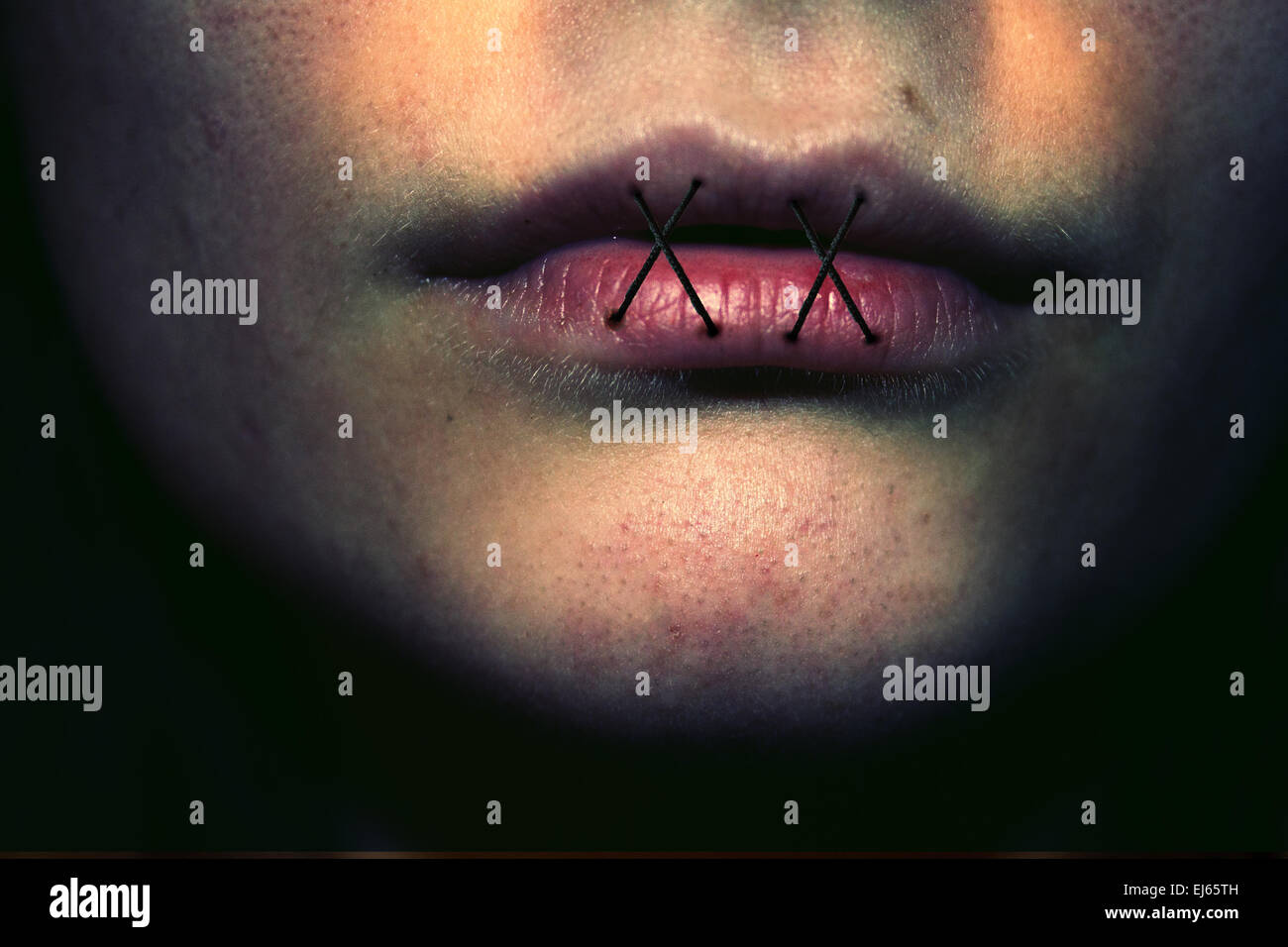 stitched lips, stitches, abuse, domestic abuse, bullying, lips, face ...