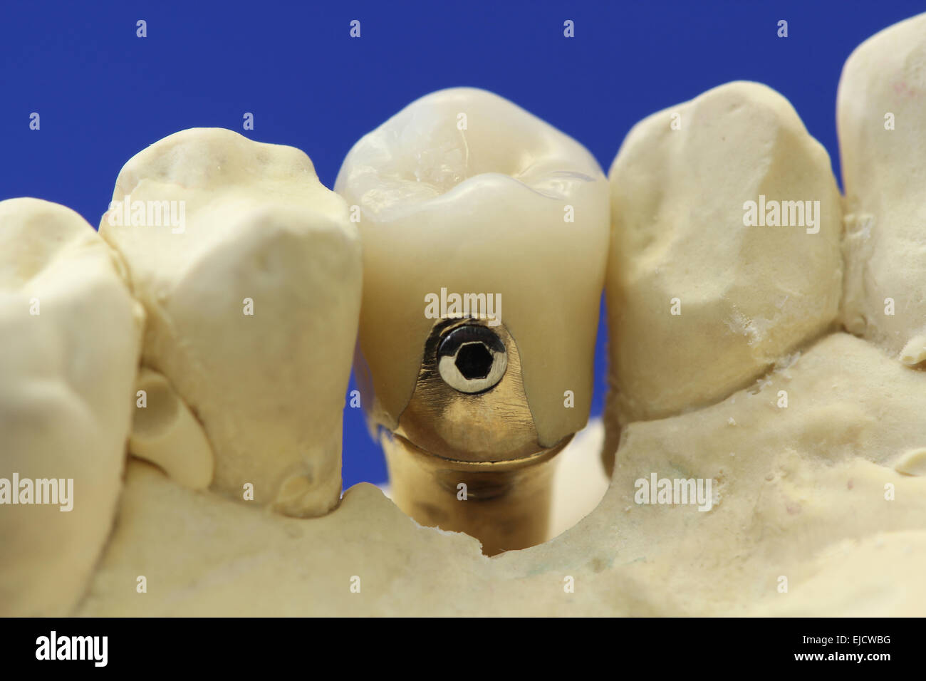 screwdown crown Stock Photo Alamy