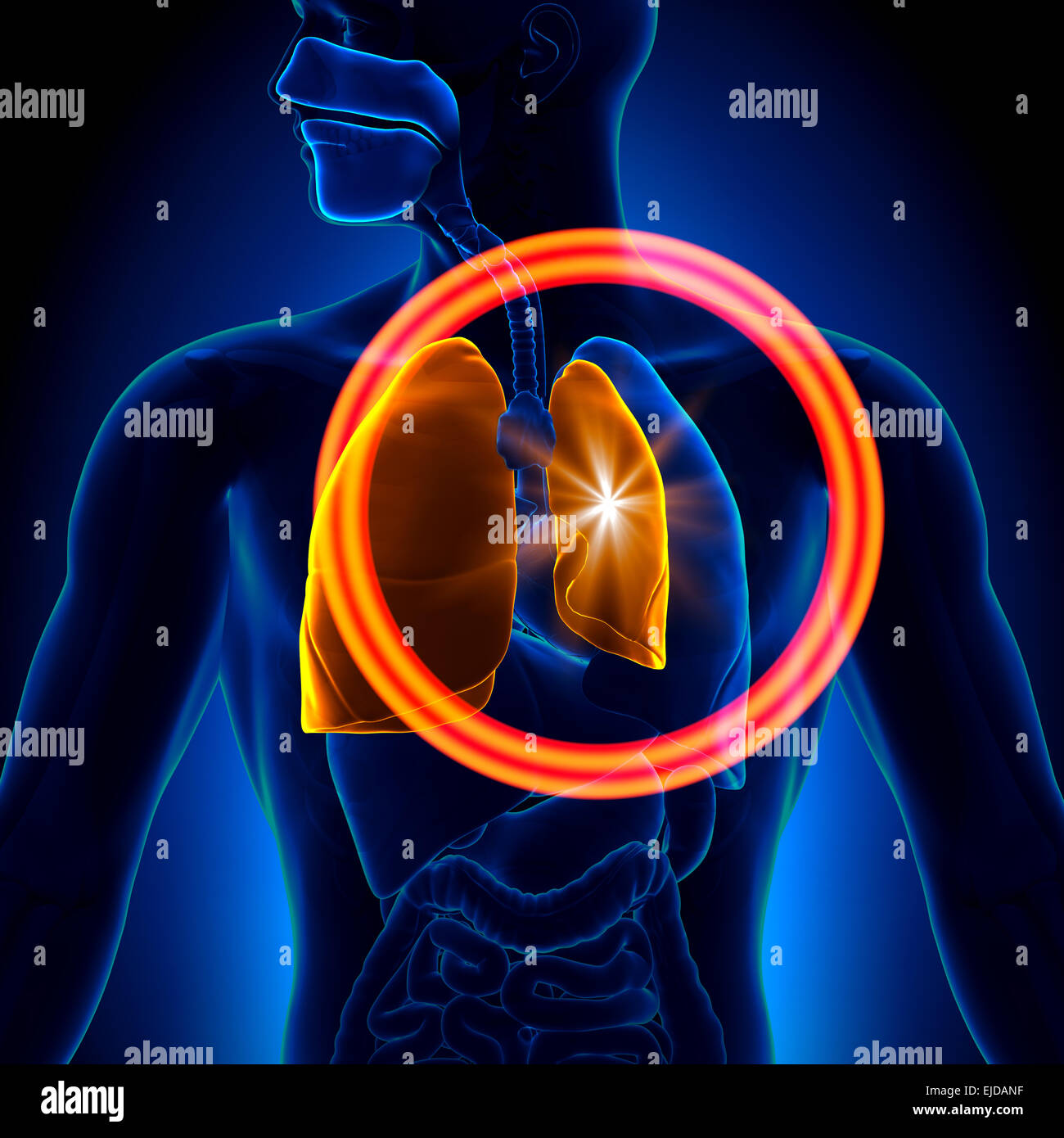 Pneumothorax - Collapsed Lung in detail Stock Photo