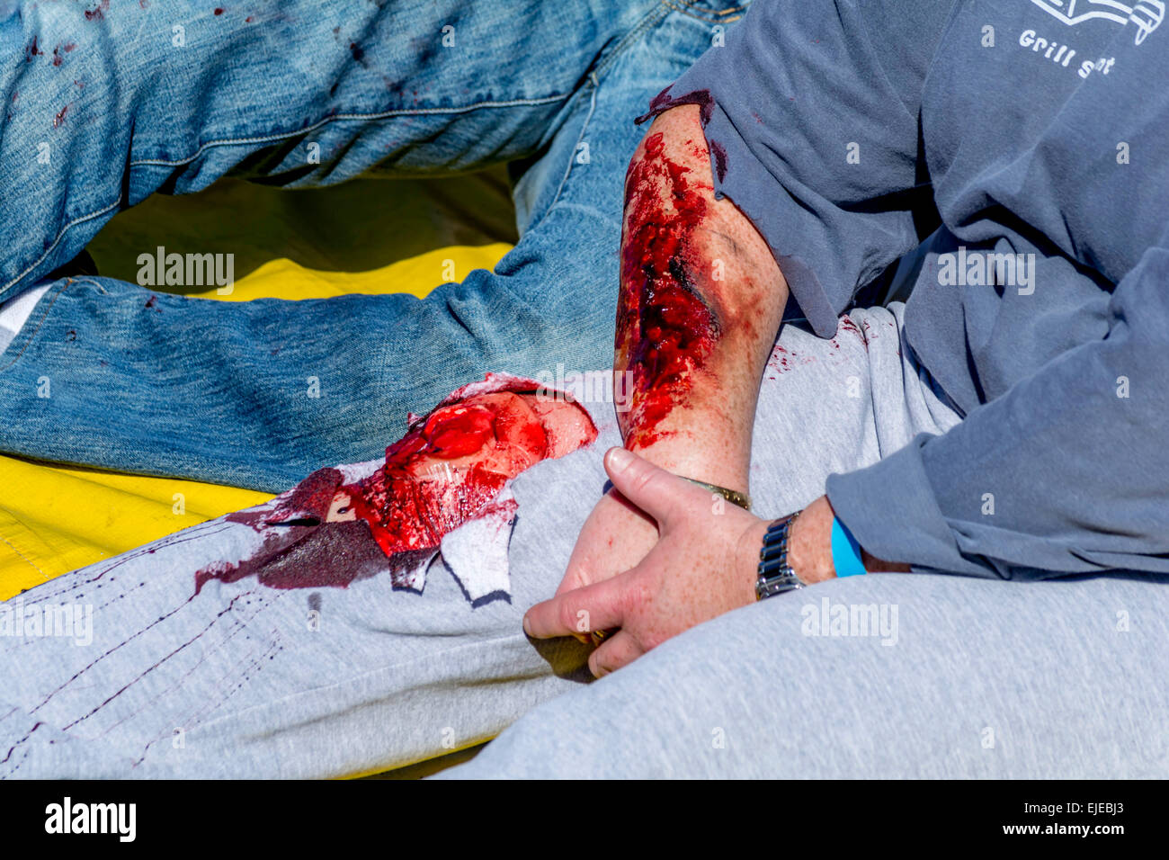 Burbank, California, USA. 24th March, 2015.  Volunteer with moulaged injuries during the Triennial Full Scale Emergency Exercise  at Bob Hope  Airport Credit:  Chester Brown/Alamy Live News Stock Photo