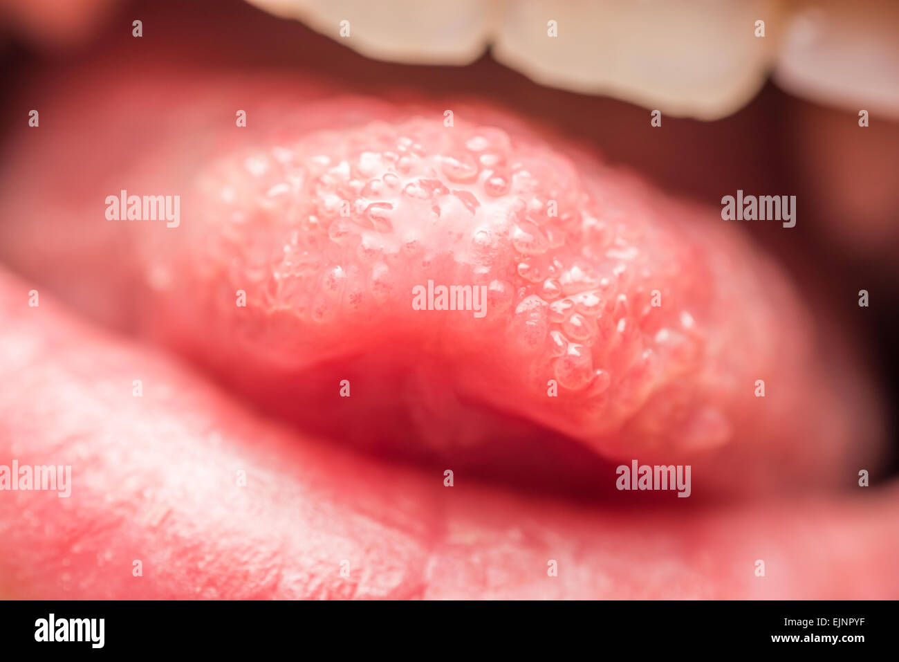 Close Up Photo Of Healthy Human Tongue Taste Buds Macro Stock Photo