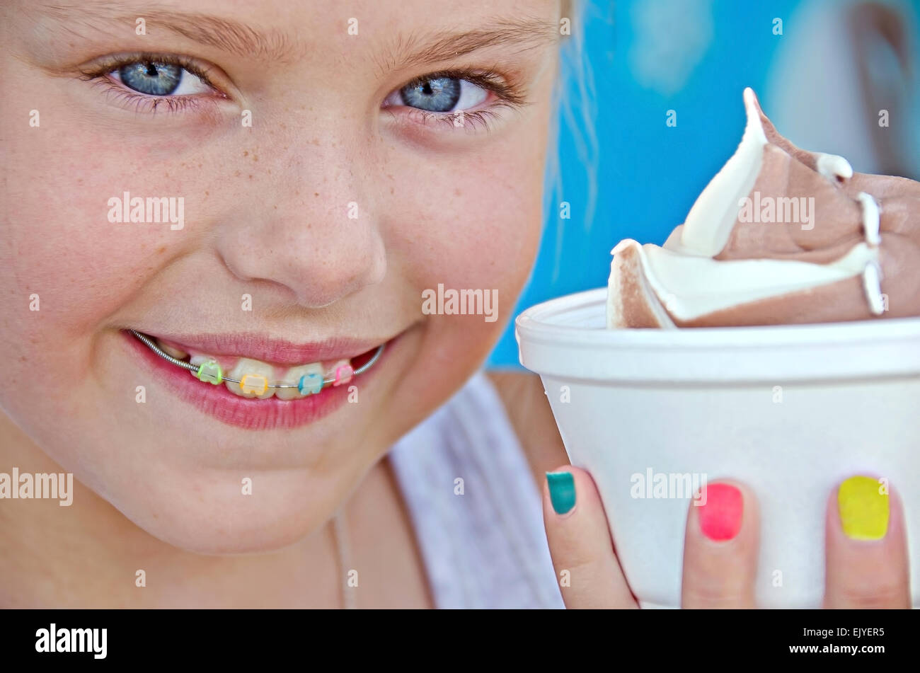 Young girl with orthodontic smile and ice cream in a cup. Stock Photo