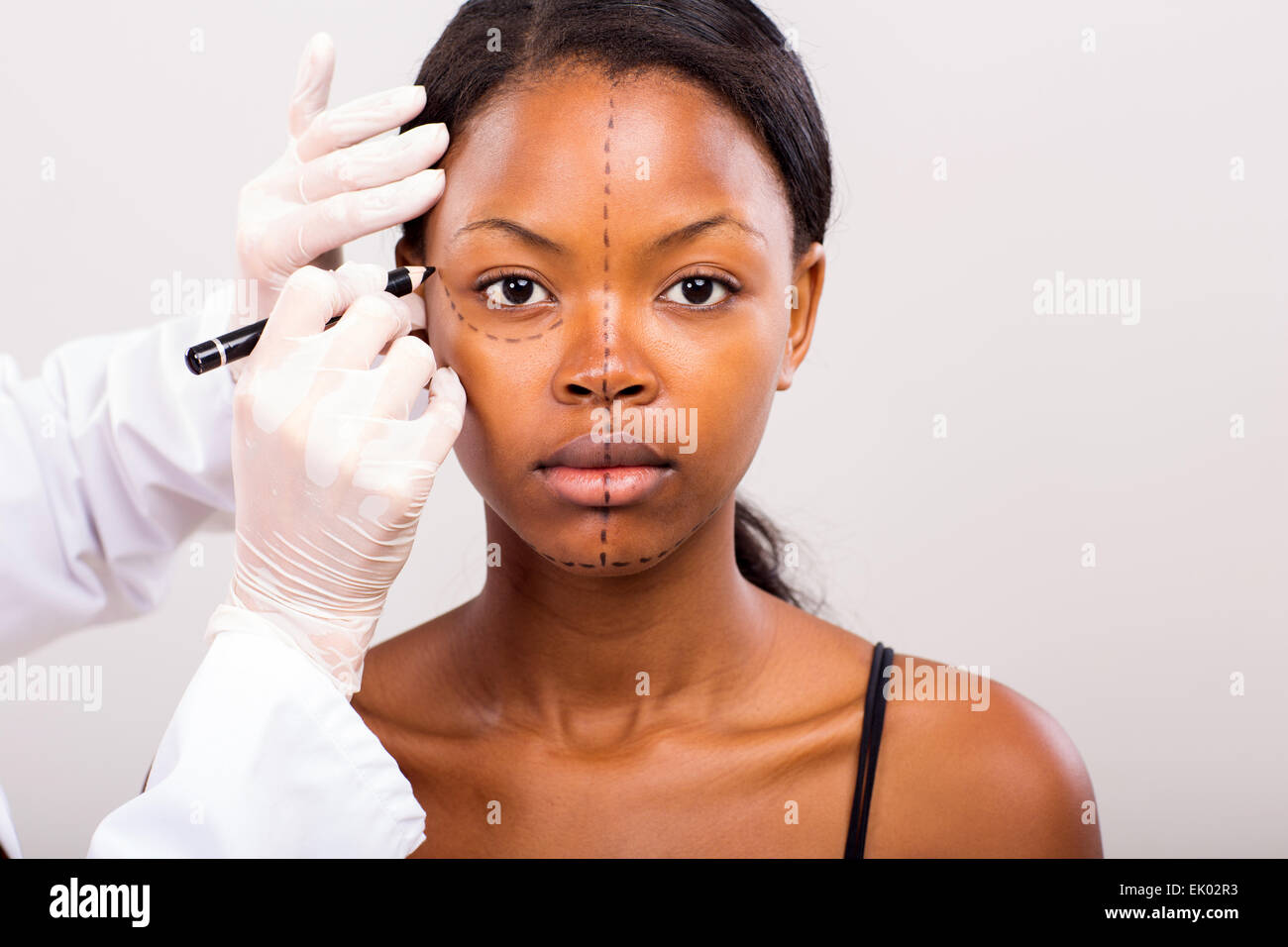 cosmetic surgeon drawing lines on African girl face for plastic surgery Stock Photo