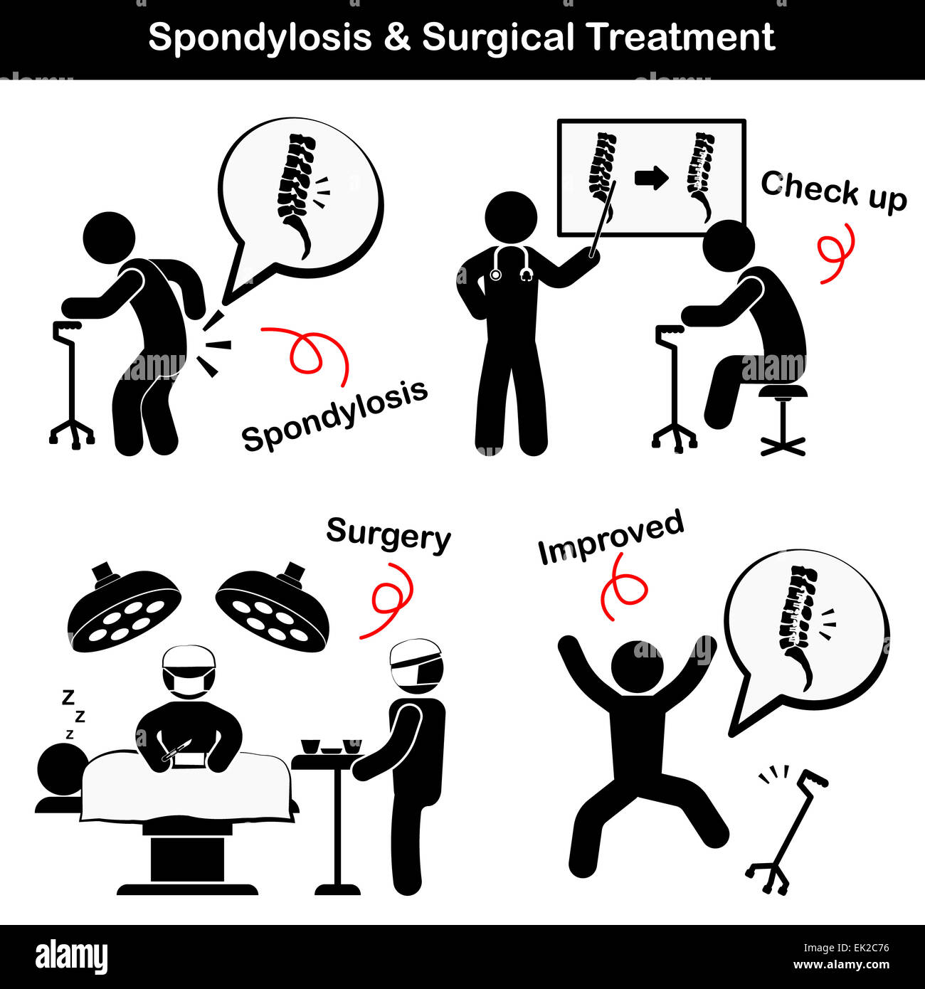 Spondylosis and Spondylolisthesis and Surgical Treatment Pictogram  ( Old man suffer to low back pain ( lumbar pain ) , He was c Stock Photo