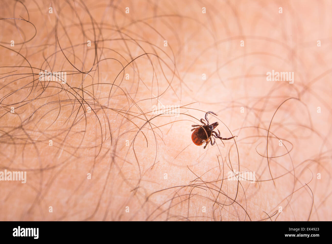 Tick - parasitic arachnid blood-sucking carrier of various diseases Stock Photo