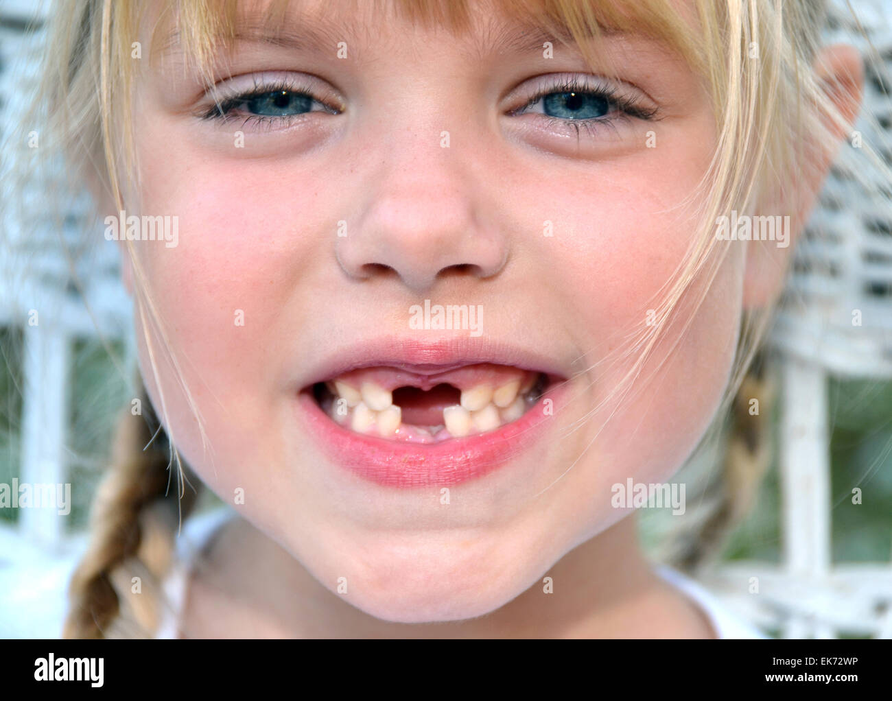 Young Caucasian girl with missing teeth. Stock Photo