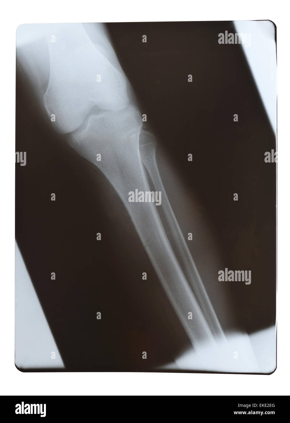 Radiology x ray Cut Out Stock Images & Pictures - Alamy