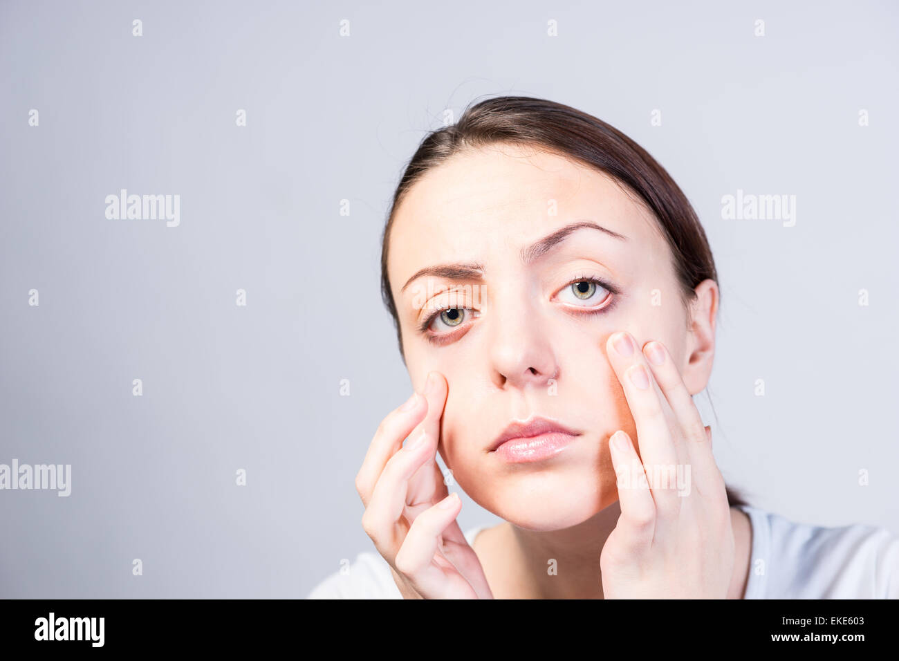 Serious Young Woman Pulling Down her Two Lower Eyelids with Both Hands ...