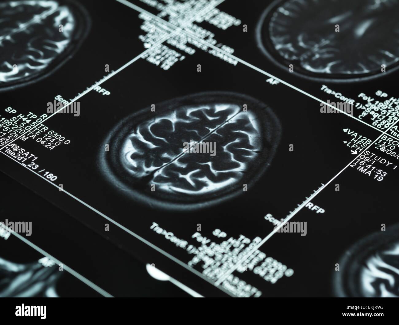 brain scan, diagnosis, diagnostics, healthcare, resonance