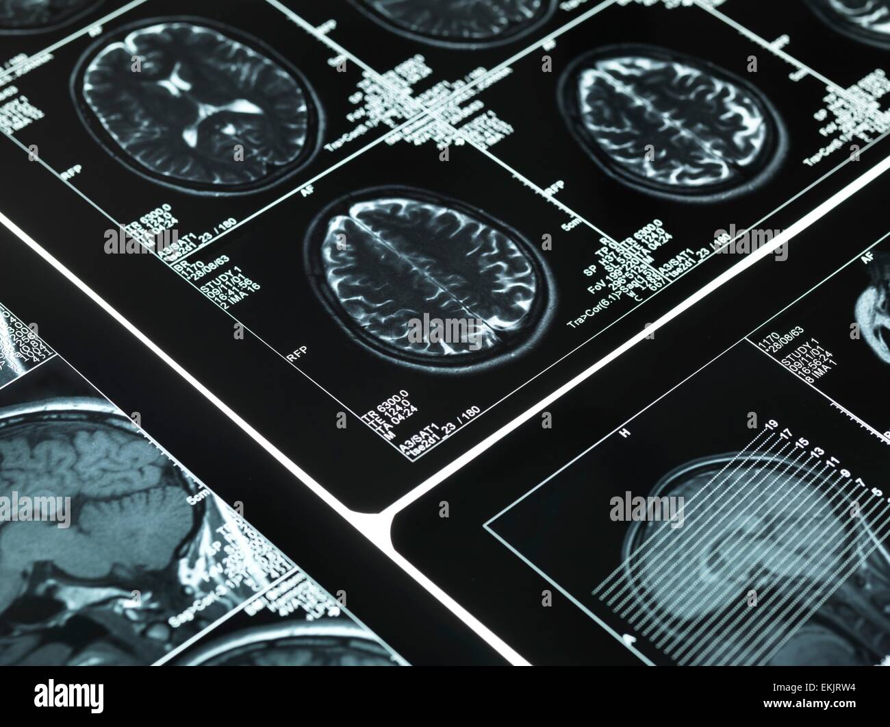 brain scan, diagnosis, diagnostics, healthcare, resonance