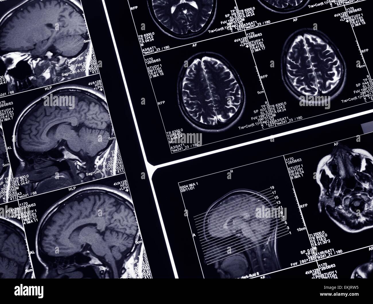 brain scan, diagnosis, diagnostics, healthcare, resonance