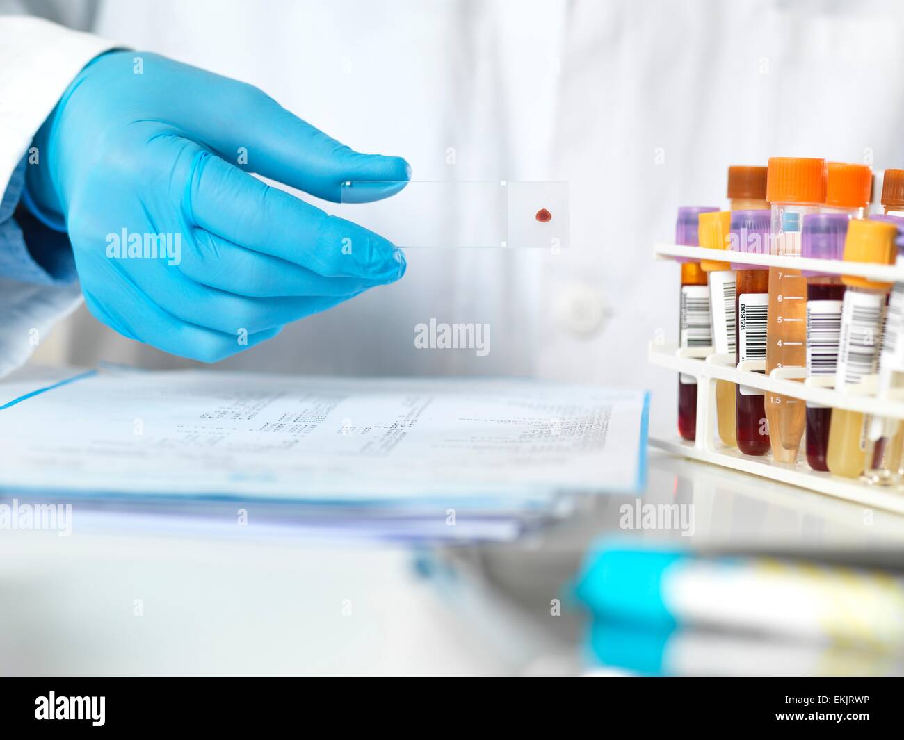 blood slide, microscope slide, adult, analysis, biological, biology