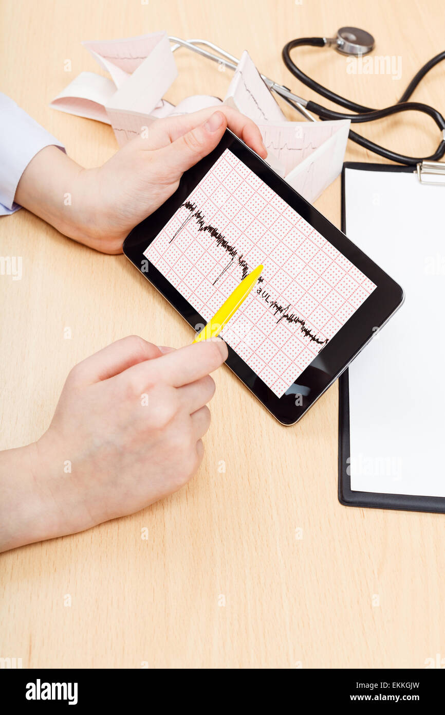 Electrocardiogram tracing paper hi-res stock photography and images - Alamy