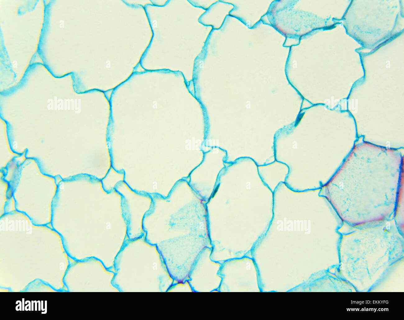 Stalk of a cereal crosssection under the microscope (Corn Stem C.S