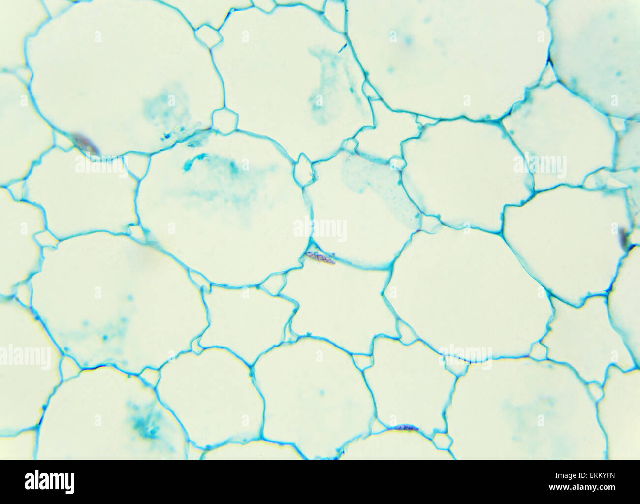 Sunflower stalk cross-section under the microscope, (Helianthus Stem C