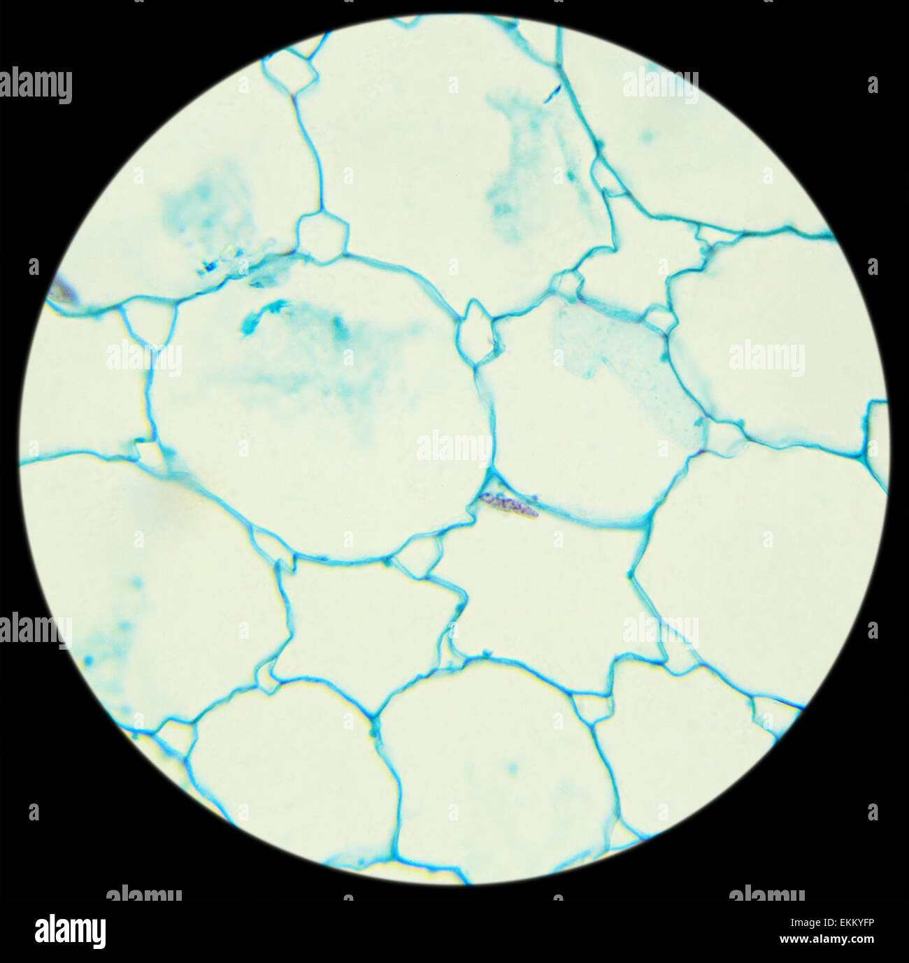Sunflower stalk crosssection under the microscope, (Helianthus Stem C