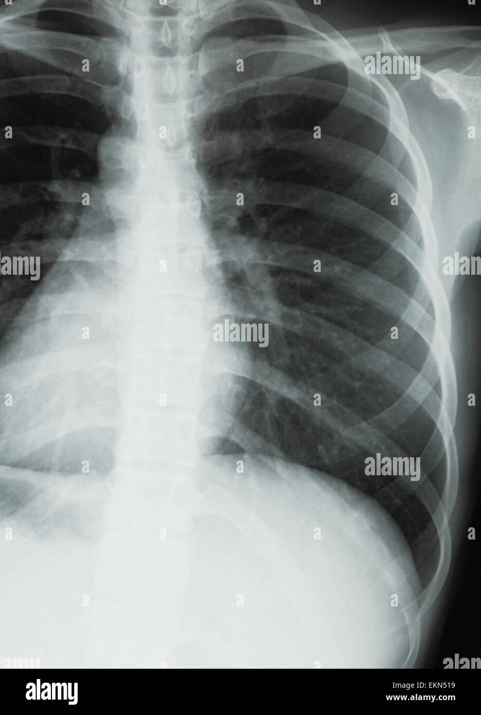 Chest xray scan Stock Photo Alamy