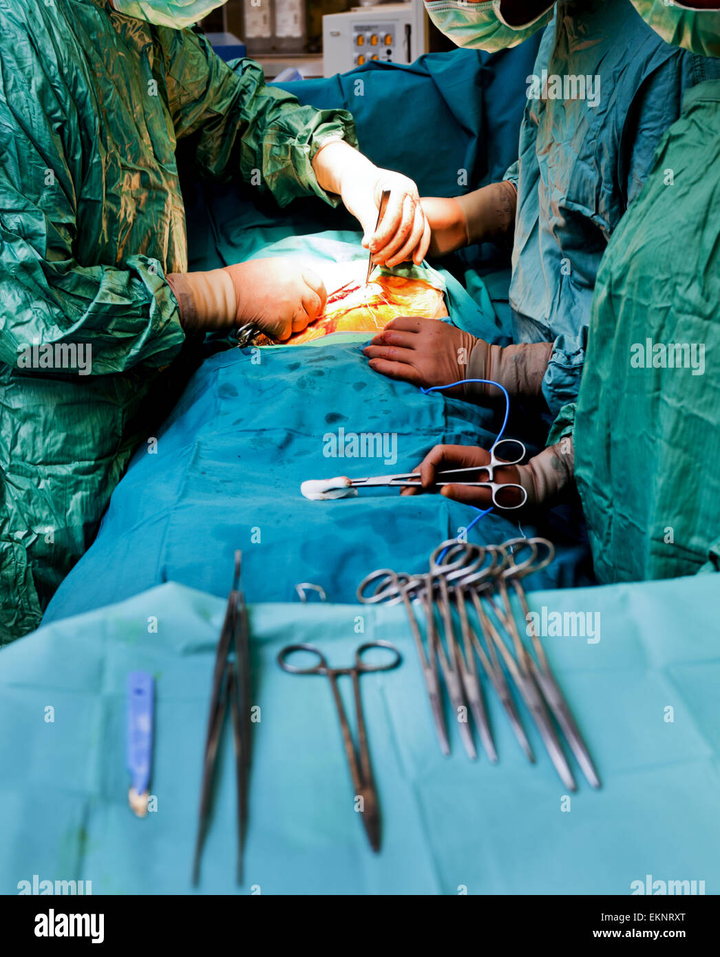 Cardiac surgery hi-res stock photography and images - Alamy