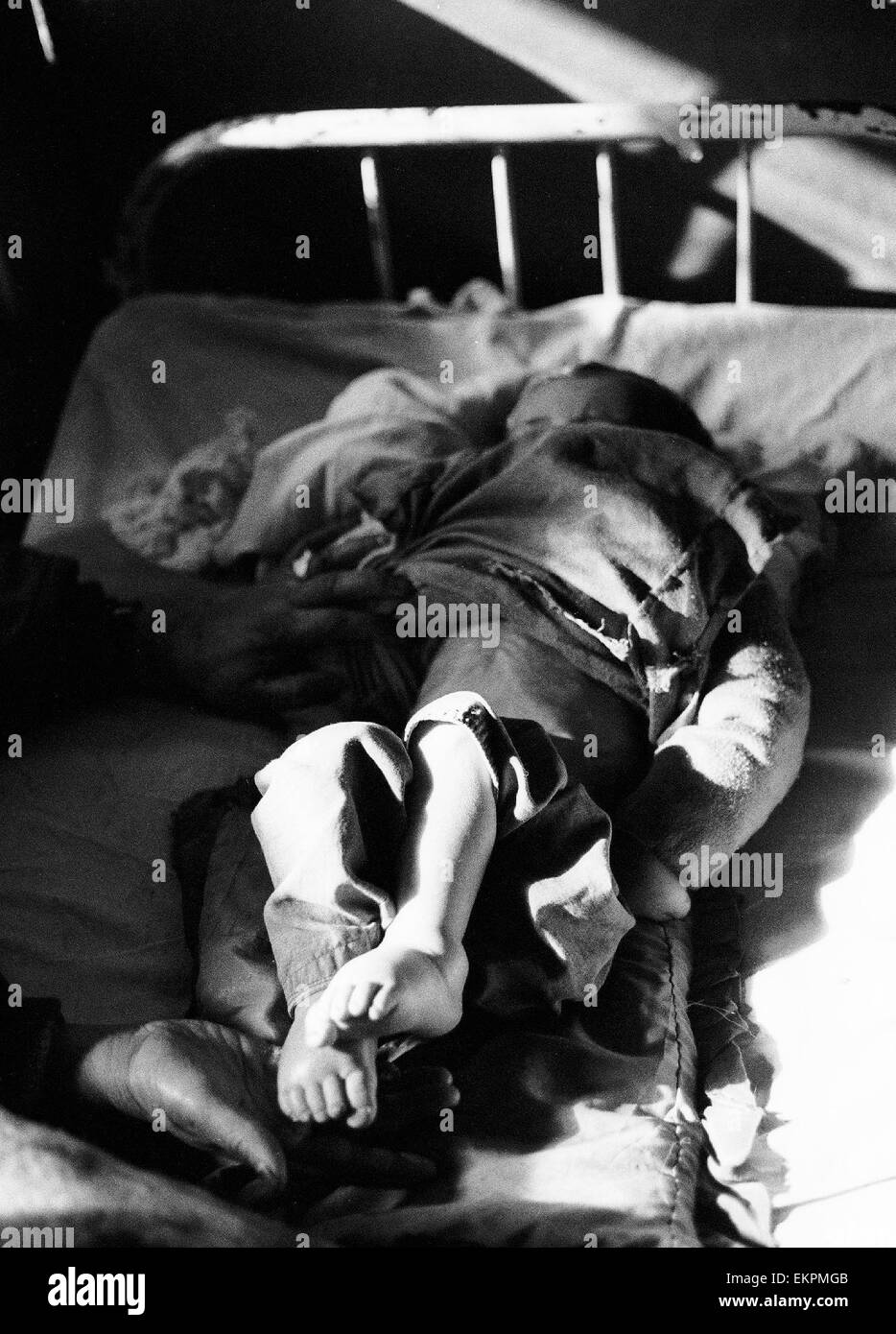 sick baby at the Indira Gandhi hospital in Kabul 1994 Afghanistan Stock Photo