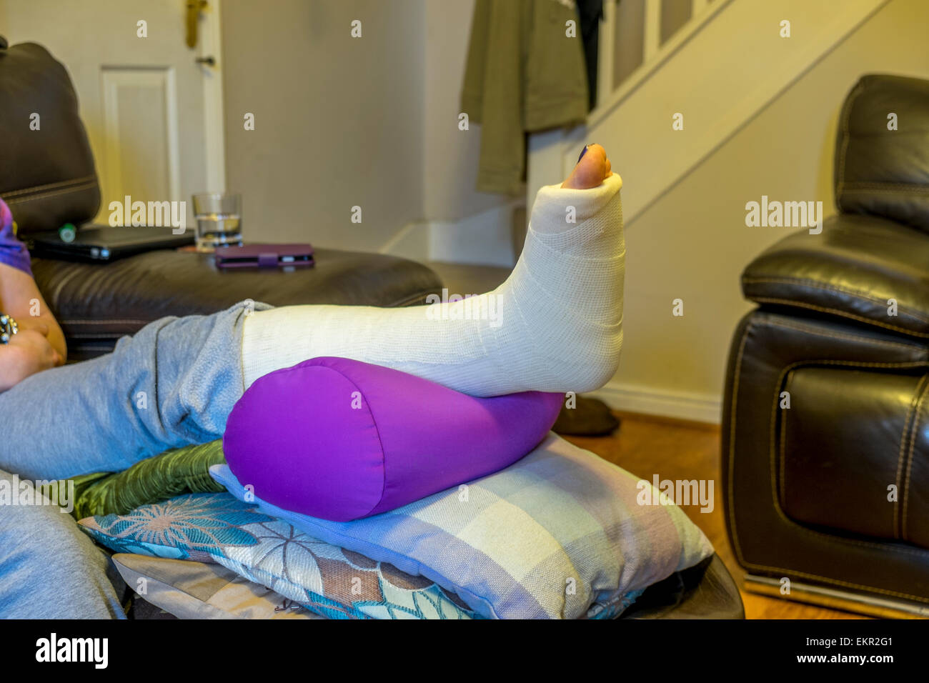 Lady with a broken ankle with her leg in an elevated position Stock Photo